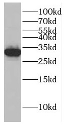 GTF2H3 antibody|GTF2H3抗体