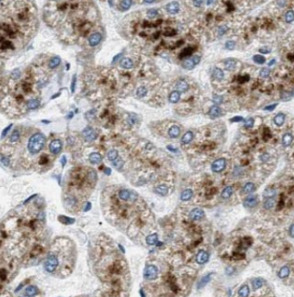 SOST antibody|SOST抗体