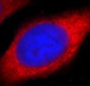 DVL2 antibody|DVL2抗体