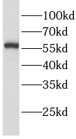 LGI3 antibody|LGI3抗体