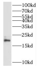 RPL23A antibody|RPL23A抗体