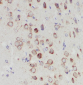 NUDCD3 antibody|NUDCD3抗体