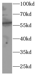GK antibody|GK抗体 FNab10019