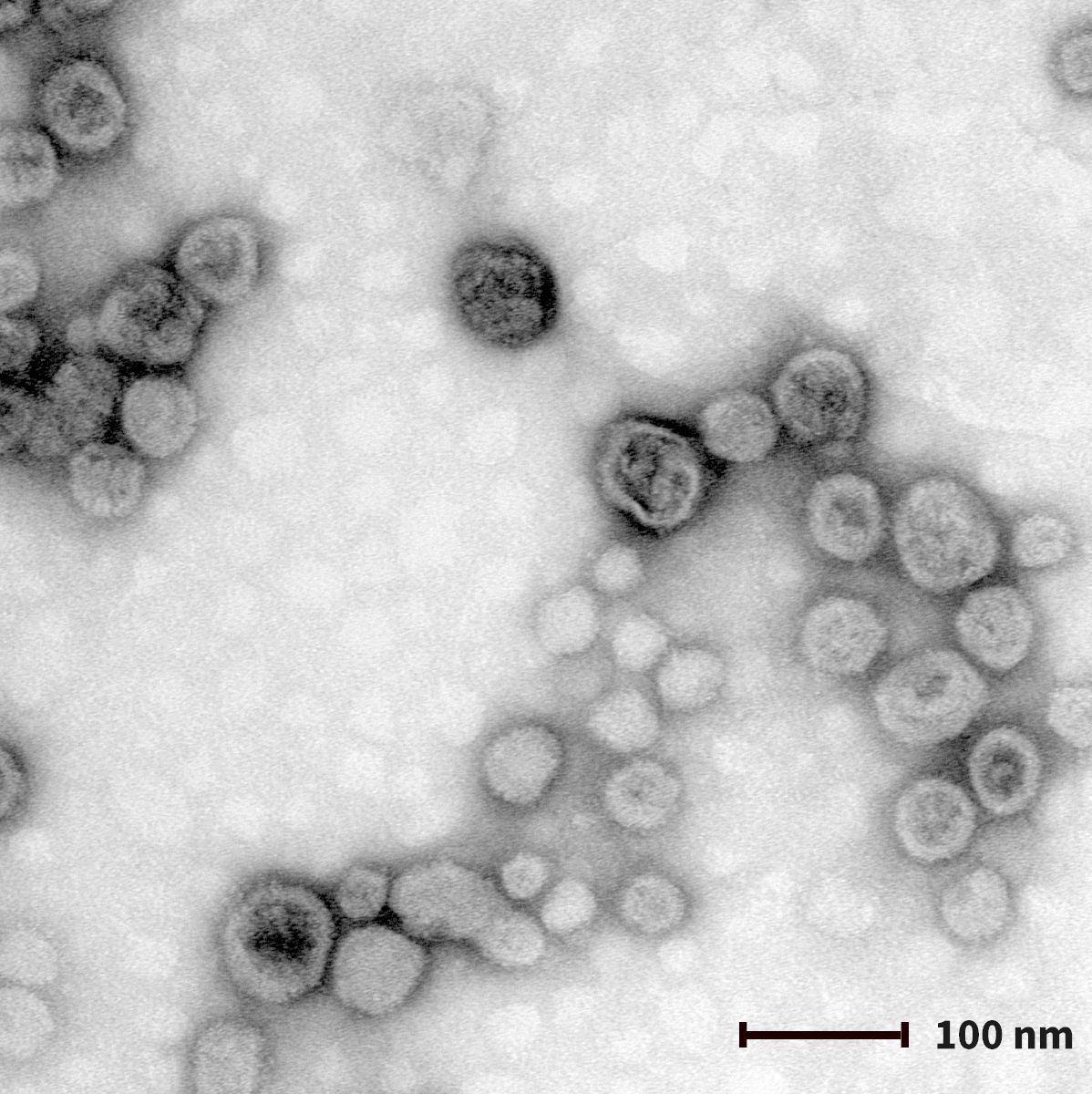外泌体提取／外泌体鉴定