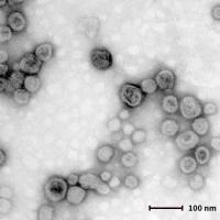 外泌体提取／外泌体鉴定