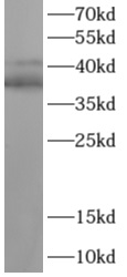 TAL1 antibody|TAL1抗体 FNab10041