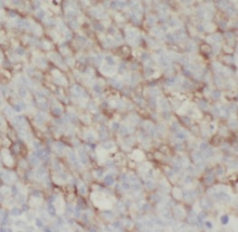 LY6D antibody|LY6D抗体