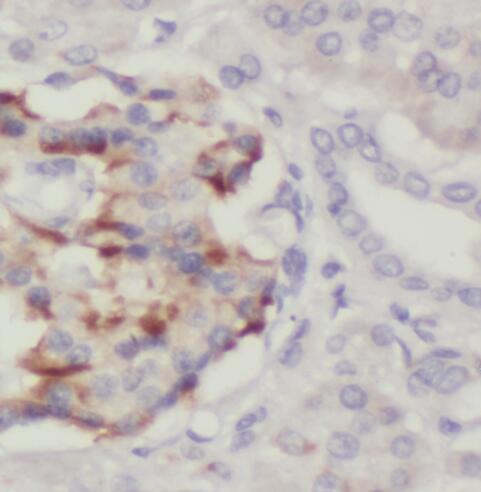 PTPN4 antibody|PTPN4抗体