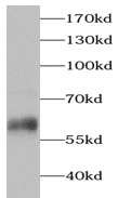 PRPH antibody|PRPH抗体
