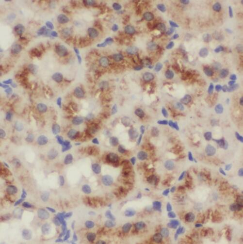 SMU1 antibody|SMU1抗体