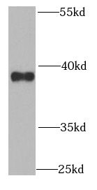 QKI antibody|QKI抗体