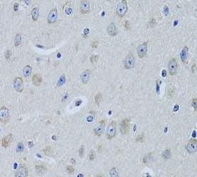 FDFT1 antibody|FDFT1抗体