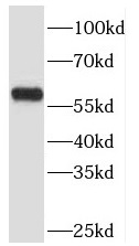 TBC1D22A antibody|TBC1D22A抗体