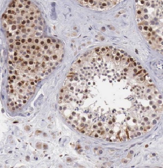 GTDC1 antibody|GTDC1抗体