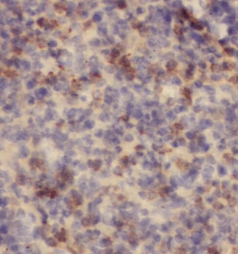 PFKFB2 antibody|PFKFB2抗体