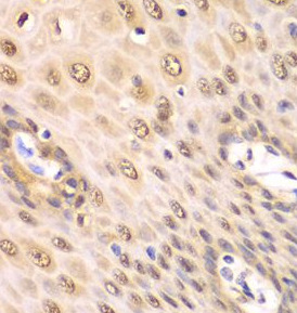 PSMA2 antibody|PSMA2抗体