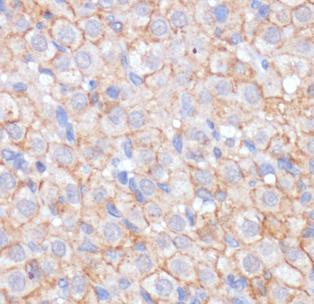 KIT antibody|KIT抗体 FNab09971