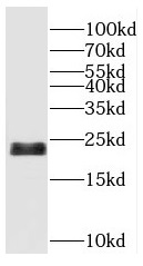 RBBP9 antibody|RBBP9抗体 FNab071