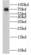 MTMR2 antibody|MTMR2抗体