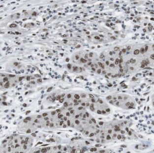 CCND3 antibody|CCND3抗体