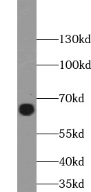 GPI antibody|GPI抗体 FNab03582
