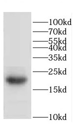 CETN2 antibody|CETN2抗体