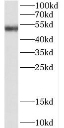CSK antibody|CSK抗体 FNab02016