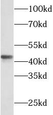 SFTPB antibody|SFTPB抗体 FNab077