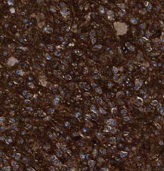 RAP1GDS1 antibody|RAP1GDS1抗体