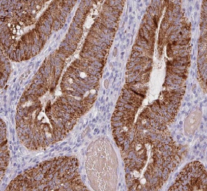 HIGD1B antibody|HIGD1B抗体