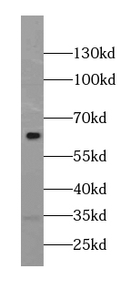 MLLT3 antibody|MLLT3抗体