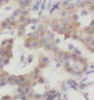 UBB antibody|UBB抗体 FNab09197