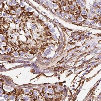 CLDN11 antibody|CLDN11抗体