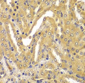 UBE2Z antibody|UBE2Z抗体