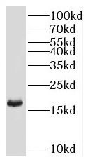 RNF181 antibody|RNF181抗体