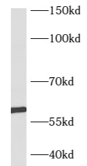 B3GLCT antibody|B3GLCT抗体