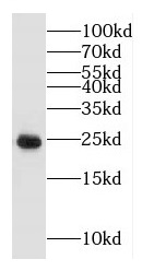 GLIPR1L1 antibody|GLIPR1L1抗体