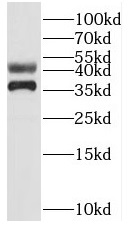 SUGT1 antibody|SUGT1抗体