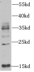 UBB antibody|UBB抗体 FNab09197