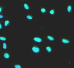 RUVBL1 antibody|RUVBL1抗体