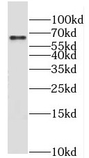 MLXIPL antibody|MLXIPL抗体