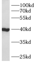 AWAT2 antibody|AWAT2抗体