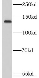 RTEL1 antibody|RTEL1抗体