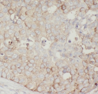 AKAP4 antibody|AKAP4抗体