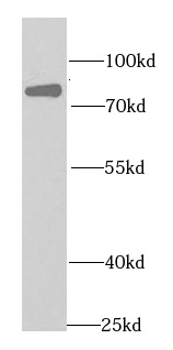 EIF4B antibody|EIF4B抗体