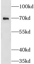 GRK5 antibody|GRK5抗体