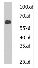 GDPD2 antibody|GDPD2抗体