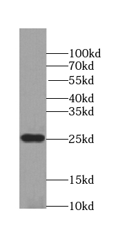 POLR2E antibody|POLR2E抗体