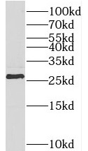 TESC antibody|TESC抗体