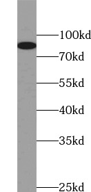HCN3 antibody|HCN3抗体